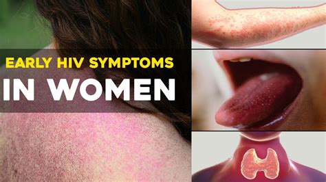 hiv positive symptoms in women