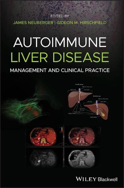 Autoimmune Liver Disease Management And Clinical Practice Hardcover