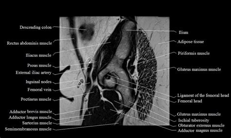 Away views of the body. MRI female pelvis anatomy | free MRI sagittal cross sectional anatomy of female pelvis