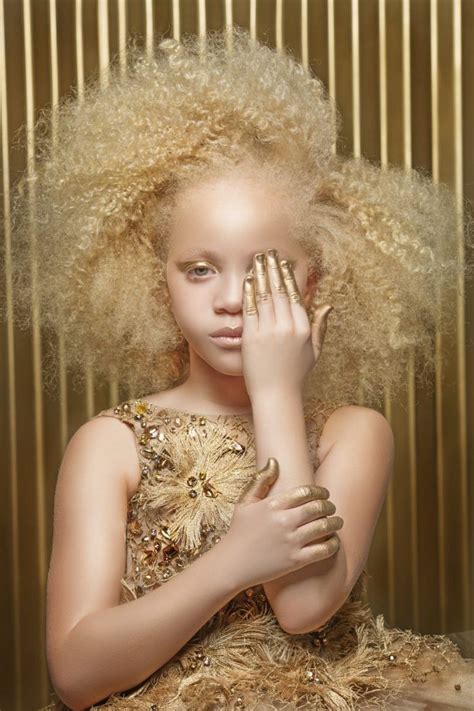 Pin By Hillary Shai On Albinos In Beauty Natural Hair Styles Hair Styles
