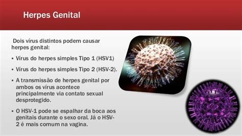Herpes Genital Ds Ts