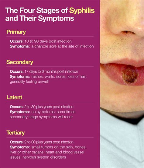 Syphilis Symptoms Syphilis Cases On The Rise A Discussion Of Symptoms