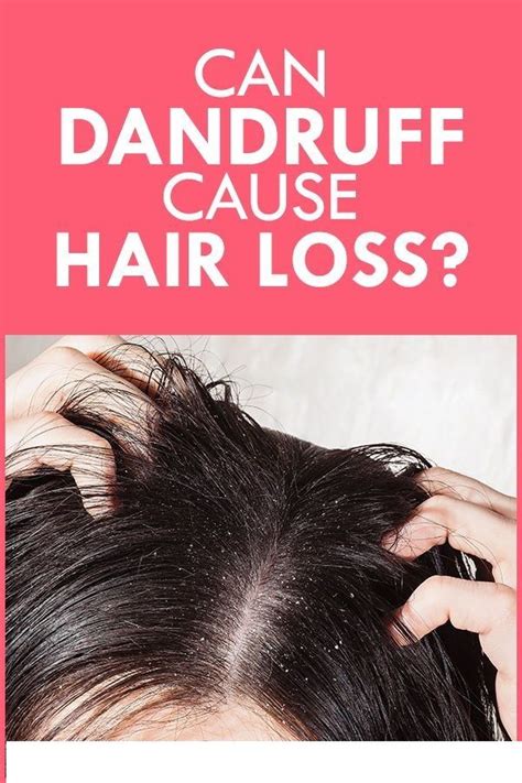 And then when you are scratching it, the flakes are falling this skin condition can cause hair loss, fortunately, it usually is only temporary. Can Dandruff Cause Hair Loss? And How To Treat It ...