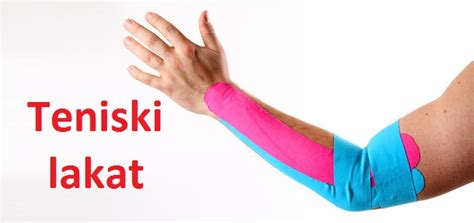 Kako se leči teniski lakat? Teniski lakat - simptomi, uzrok, terapija i lečenje