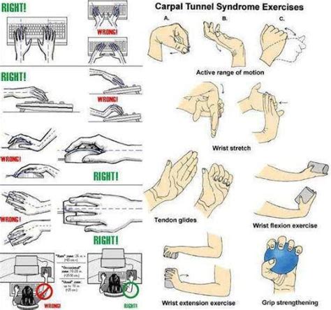 The national institute of neurological disorders and stroke (ninds), describe carpal tunnel syndrome (cts) as the most common and widely known of the. Carpal Tunnel Syndrome Exercises | Carpal tunnel syndrome ...