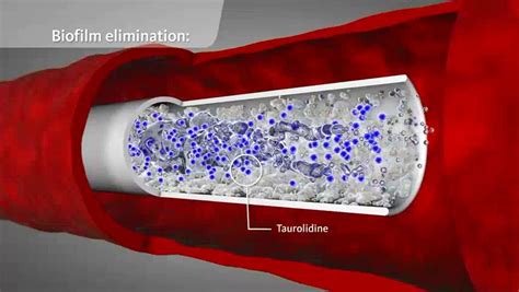 Another growing concern of crbsi (and infections in general) is the alarming rates of bacterial antibiotic resistance. Geistlich TauroSept® | CRBSI | Geistlich Medical