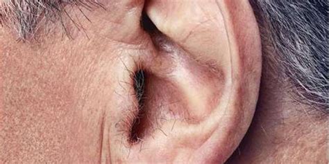 Ear Hairs Can Be A Cause Of Cancer In Hindi स्‍वास्‍थ्‍य समाचार