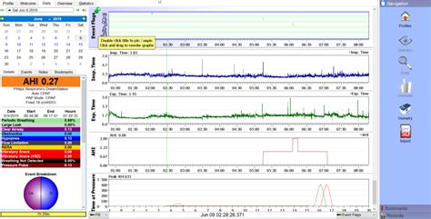 OSCAR - Open Source CPAP Analysis Reporter | AndyMelton.net