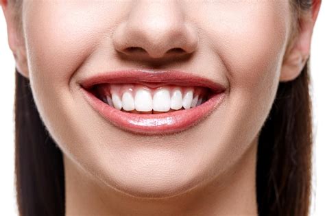 Teeth Whitening Milton Solutions For Teeth Whitening In Milton