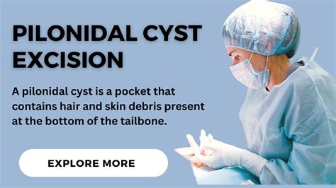 Pilonidal Cyst Excision Surgery All You Need To Know Vipon