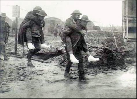 World One War Infamous Trench Foot