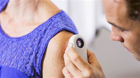 Learn about skin cancer, including basal cell carcinoma, melanoma and squamous cell carcinoma. Melanoma or Liver Spots? How to Tell the Difference