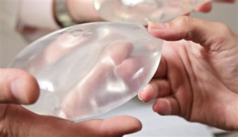 Fda Warns Of Rare Cancer Linked To Breast Implants Wsvn 7news Miami