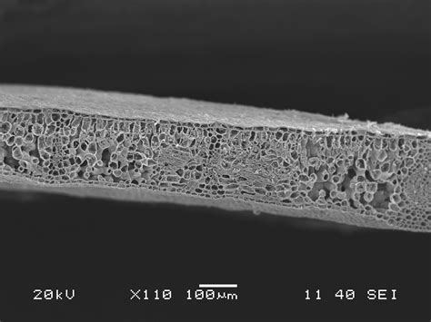 » Freeze fracture samples under the SEM Fungal Pathogens ...