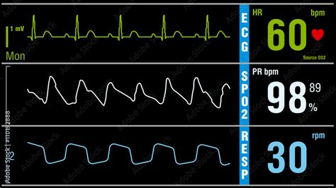 Vetor De Patient Monitor Displays Vital Signs Ecg Electrocardiogram Ekg