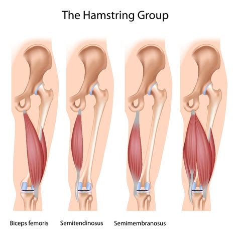 Runners How To Treat And Prevent Hamstring Pain
