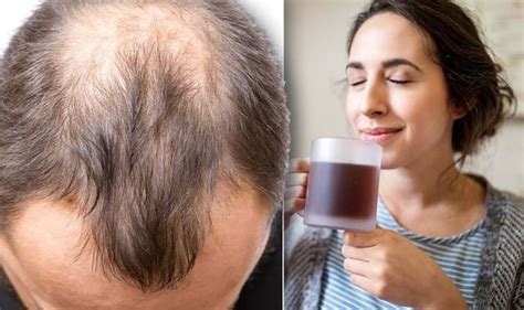 Hair Loss Treatment Prevent Alopecia And Boost Hair Growth At Home With Green Tea Diet
