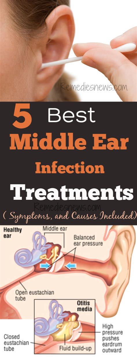 Middle Ear Infection Treatments Symptoms And Causes 5 Natural Remedies