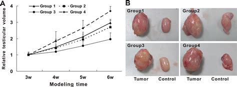Increased Efficiency Of Testicular Tumor Chemotherapy By Ultrasound