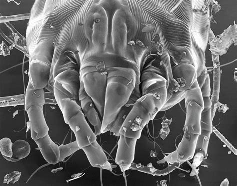 Dust Mite Photograph By Dennis Kunkel Microscopyscience Photo Library