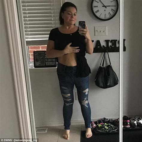 body transformation amanda nauffts has excess skin removed after 156lb weight loss daily mail