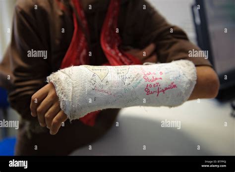 Broken Arm In A Cast Covered With Signatures Stock Photo Alamy