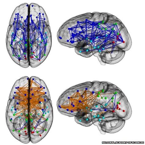 Men And Womens Brains Are Wired Differently Bbc News