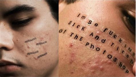 Acne Normalizing Photography Photography Like Instagram Tattoo Quotes
