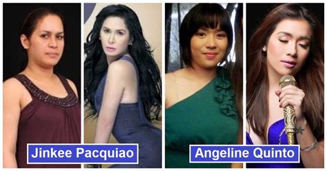 8 Filipina Celebrities Who Admitted To Undergoing Cosmetic Surgery