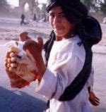Check spelling or type a new query. Amputation in Islam - WikiIslam