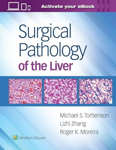Surgical Pathology Of The Liver Torbenson Md Michael Moreira Md