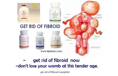 Forever Living Products Fastest Solution To Fibroid And Infertility
