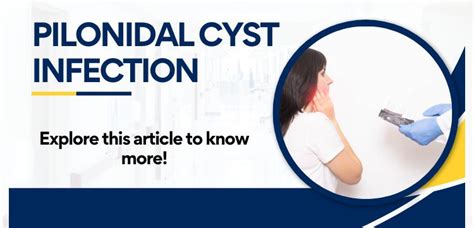 Discover Effective And Convenient Home Treatments For Pilonidal Cysts