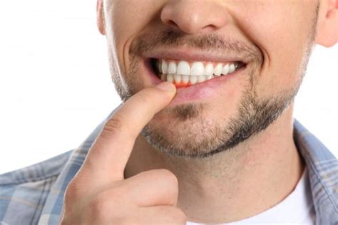 7 Reasons Why You May Have A Bump On Your Gums