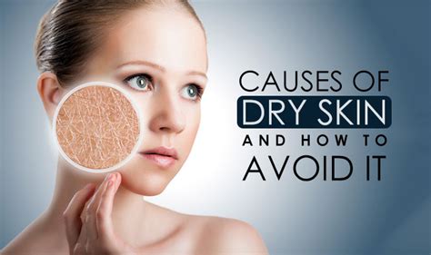 Causes Of Dry Skin And How To Avoid It Neostopzone