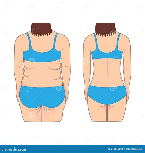 Woman S Back Before And After Weight Loss Vector Illustration Stock Vector Illustration Of