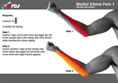 Medial Elbow Pain