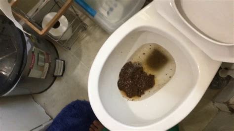 Gross Pictures Poop