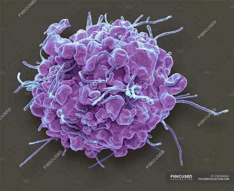 Coloured Scanning Electron Micrograph Of 293t Cell In Early Stage Of