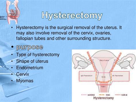 Fixation Of Uterus After Whole Hysterectomy