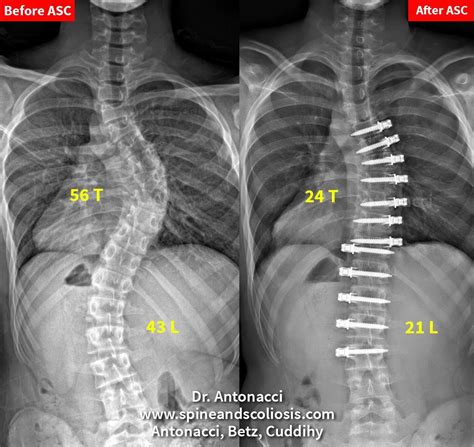 Lumbar Spine Diagram