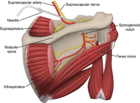 Supra Scapular Nerve Entrapment Dr Rahul Bade