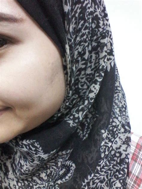 A gentle formula that thoroughly cleanses to remove dirt and impurities from the skin. Cik Putri: Review / Testimoni : Nour Ain Skin Care , Bio ...