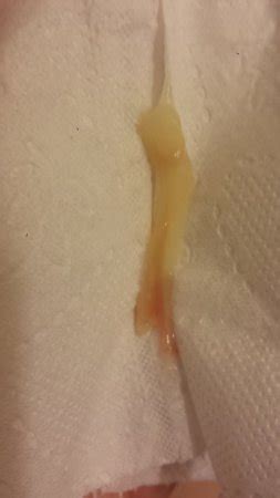 The mucus plug is roughly the size of a quarter and made up of around 2 tablespoons of mucus. Pic included not for the weak ha! plug and bloody show ...