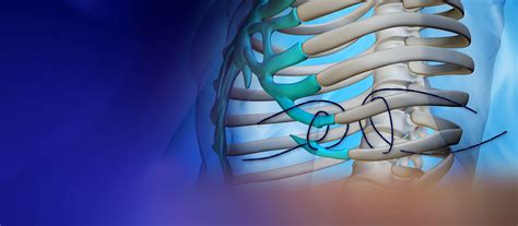 Uhc Surgeon Provides Non Invasive Treatment For Slipping Rib Syndrome