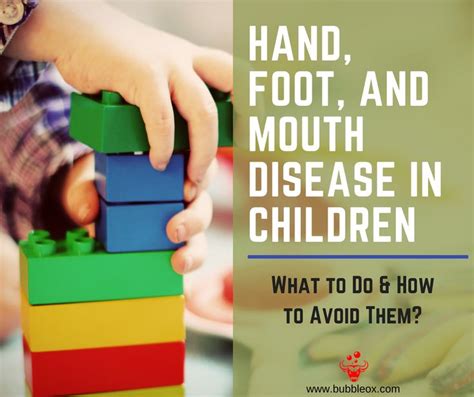 Hand Foot And Mouth Disease In Children What To Do And How To Avoid