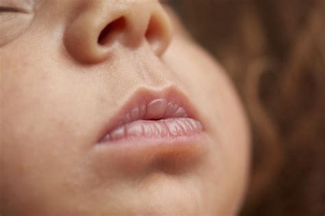 Newborn Chapped Lips Treatment And Causes