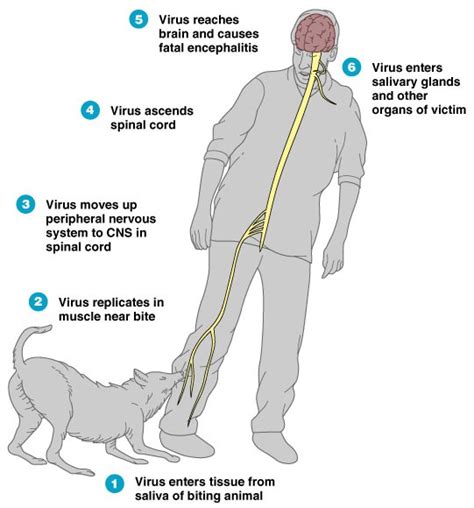 What Is Rabies Causes Symptoms And Treatment Mediologiest