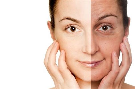 Understanding Skin Abrasion Based Rejuvenation Kosmoderma
