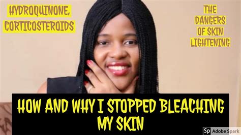 Effect Of Skin Bleaching My Skin Bleaching Story Youtube